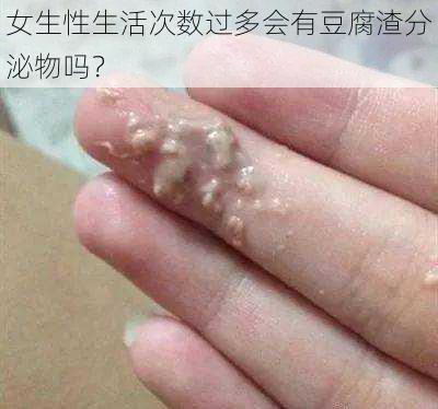 女生性生活次数过多会有豆腐渣分泌物吗？